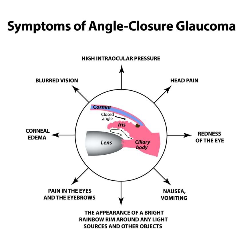 closure-glaucoma