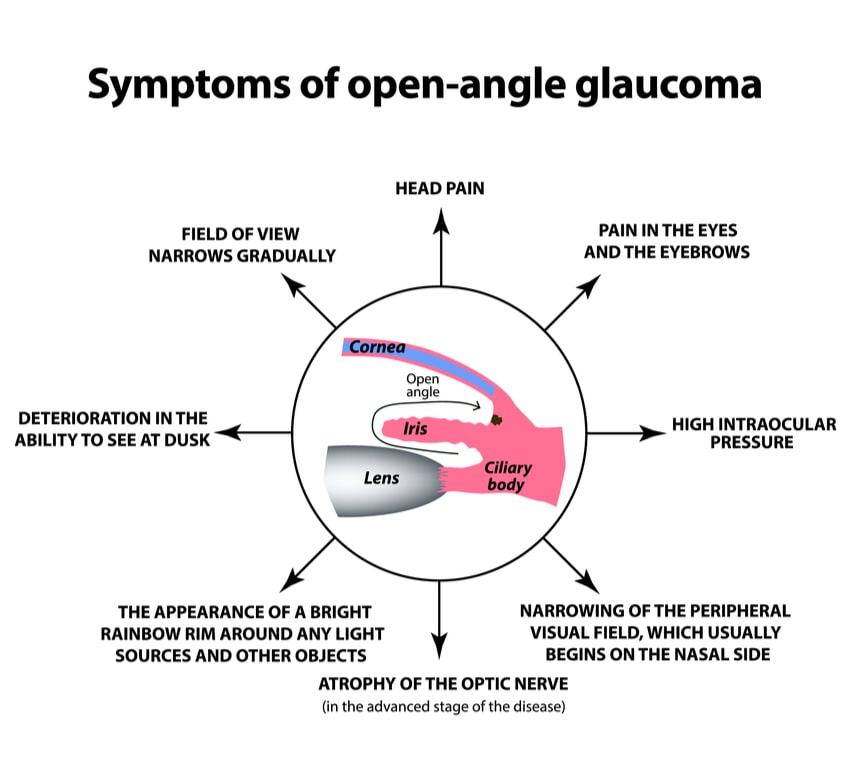 glaucoma treatment